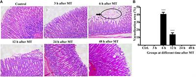 Effects of Non-directional <mark class="highlighted">Mechanical Trauma</mark> on Gastrointestinal Tract Injury in Rats